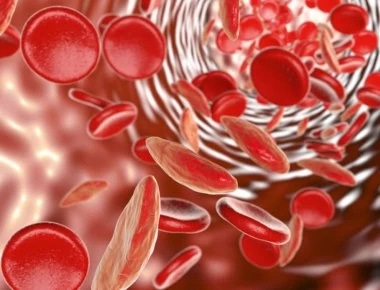 Σιδηροπενική αναιμία: Αυτά είναι τα πρώιμα συμπτώματα